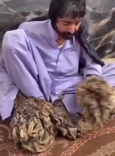 مرد درختی ایران