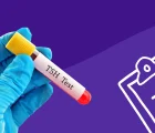 معنی TSH در آزمایش خون