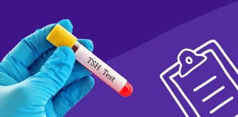 معنی TSH در آزمایش خون